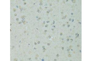 Immunohistochemistry of paraffin-embedded Rat brain using TRIM28 Polyclonal Antibody at dilution of 1:100 (40x lens).