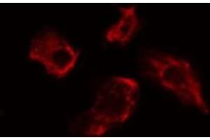 ABIN6275482 staining Hela cells by IF/ICC.