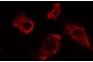ABIN6275482 staining Hela cells by IF/ICC. (RGS7 anticorps  (Internal Region))