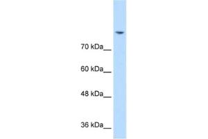 Western Blotting (WB) image for anti-Discs, Large Homolog 2 (DLG2) antibody (ABIN2462725) (DLG2 anticorps)