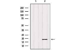 Western blot analysis of extracts from Cos-7, using PIGP Antibody. (PIGP anticorps)
