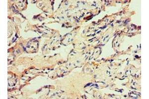 Immunohistochemistry of paraffin-embedded human placenta tissue using ABIN7156485 at dilution of 1:100 (Integrin beta 3 anticorps  (AA 609-788))
