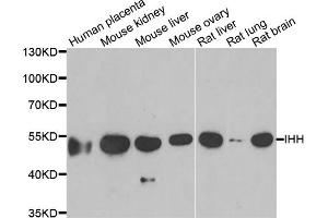 Western blot analysis of extracts of various cell lines, using IHH antibody (ABIN5973985) at 1/1000 dilution. (Indian Hedgehog anticorps)