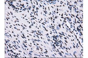 Immunohistochemical staining of paraffin-embedded colon tissue using anti-RPA2 mouse monoclonal antibody. (RPA2 anticorps)