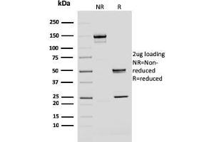 SDS-PAGE Analysis Purified BMI1 Mouse Monoclonal Antibody (BMI1/2690).