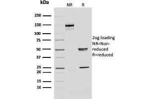 SDS-PAGE Analysis Purified BMI1 Mouse Monoclonal Antibody (BMI1/2690). (BMI1 anticorps  (AA 142-326))