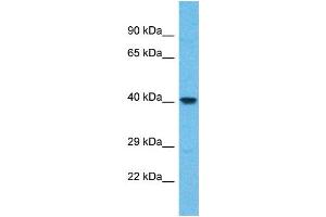 Western Blotting (WB) image for anti-WD Repeat Domain 86 (WDR86) (N-Term) antibody (ABIN2791988) (WDR86 anticorps  (N-Term))