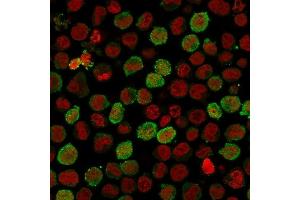 Immunofluorescence Analysis of Human K562 cells labeling CD71 with Calponin Rabbit Recombinant Monoclonal Antibody (CNN1/1408R)followed by Goat anti-rabbit IgG-CF488 (Green).