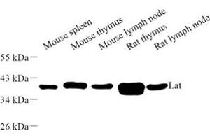 Western blot analysis of Lat (ABIN7074502) at dilution of 1: 500 (LAT anticorps)
