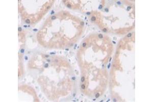IHC-P analysis of Human Tissue, with DAB staining. (RAC1 anticorps  (AA 1-189))