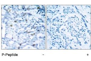 Image no. 1 for anti-Cyclin-Dependent Kinase 1 (CDK1) (pThr161) antibody (ABIN196846) (CDK1 anticorps  (pThr161))