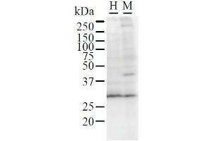 Detection of GATAD1 by Western Blot. (GATAD1 anticorps)