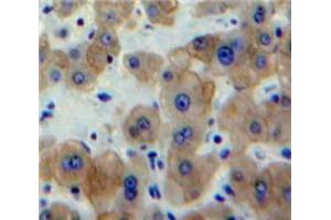 Used in DAB staining on fromalin fixed paraffin-embedded Liver tissue (EGR1 anticorps  (AA 273-431))
