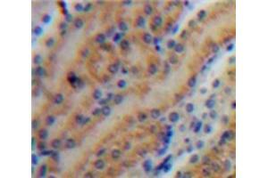 Used in DAB staining on fromalin fixed paraffin-embedded Kidney tissue (MMP7 anticorps  (AA 1-267))