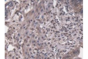 Detection of PRKDC in Mouse Uterus Tissue using Polyclonal Antibody to Protein Kinase, DNA Activated, Catalytic Polypeptide (PRKDC)