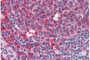 Human Tonsil (formalin-fixed, paraffin-embedded) stained with SYK antibody ABIN334248 at 10 ug/ml followed by biotinylated anti-mouse IgG secondary antibody ABIN481714, alkaline phosphatase-streptavidin and chromogen. (SYK anticorps  (AA 5-360))