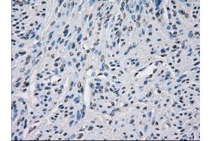 Immunohistochemical staining of paraffin-embedded endometrium tissue using anti-BUB1Bmouse monoclonal antibody. (BUB1B anticorps)