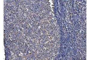 IHC analysis of CD14 using anti-CD14 antibody (ABIN7600531).