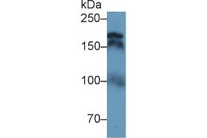 Western Blot; Sample: Human Serum; Primary Ab: 1µg/ml Rabbit Anti-Human TOP2 Antibody Second Ab: 0. (TOP2 anticorps  (AA 923-1148))
