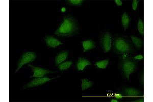 Immunofluorescence of monoclonal antibody to STIM1 on HeLa cell. (STIM1 anticorps  (AA 24-685))
