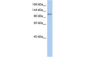 WB Suggested Anti-ZNF217 Antibody Titration:  0. (ZNF217 anticorps  (N-Term))