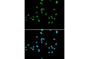 Immunofluorescence analysis of A549 cell using NR5A2 antibody. (NR5A2 + LRH1 anticorps)