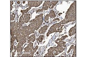 IHC analysis of FABP-1/GOT2 using anti-FABP-1/GOT2 antibody (ABIN7601426). (GOT2 anticorps  (AA 35-430))