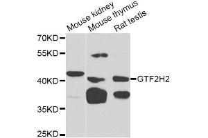 Western blot analysis of extracts of various cell lines, using GTF2H2 Antibody (ABIN1876505) at 1:1000 dilution. (GTF2H2 anticorps)