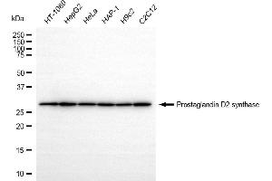 anti-Prostaglandin D2 Synthase (PTGDS) antibody