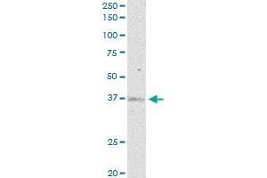 CD200R1 MaxPab rabbit polyclonal antibody. (CD200R1 anticorps  (AA 1-348))
