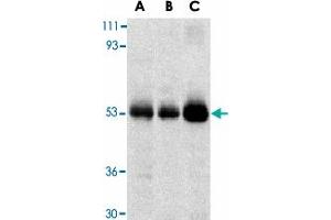 Western blot analysis of TRIM5 expression in human stomach (A), thymus (B), and uterus (C) cell lysate with TRIM5 alpha polyclonal antibody  at 2 ug /mL . (TRIM5 anticorps  (C-Term))