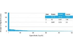 Analysis of Protein Array containing more than 19,000 full-length human proteins using CD11b Monospecific Mouse Monoclonal Antibody (ITGAM/3337).