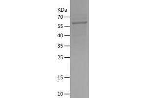 Western Blotting (WB) image for CD4 (CD4) (AA 31-395) protein (His-IF2DI Tag) (ABIN7122205)