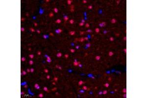 Immunofluorescence of paraffin embedded rat corpus striatum using NCBP2 (ABIN7074870) at dilution of 1: 650 (400x lens) (NCBP2 anticorps)