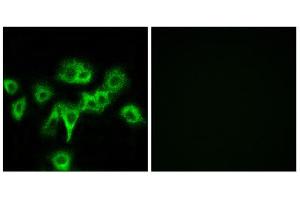 Immunofluorescence analysis of MCF-7 cells, using CDON antibody. (CDON anticorps  (Internal Region))