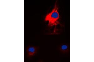 Immunofluorescent analysis of HARS staining in K562 cells. (HARS1/Jo-1 anticorps  (C-Term))