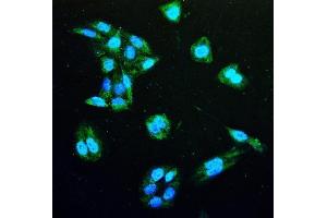 IF analysis of IDH1 using anti-IDH1 antibody (ABIN7602760).
