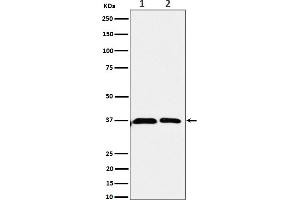 Western blot analysis of Serine racemase expression in (1) 293 cell lysate, (2) U-87 MG cell lysate.