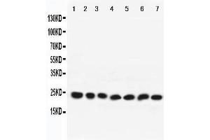 Western Blotting (WB) image for anti-RAB9A, Member RAS Oncogene Family (RAB9A) (AA 178-193), (C-Term) antibody (ABIN3042553) (RAB9A anticorps  (C-Term))