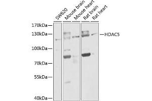 Western blot analysis of extracts of various cell lines, using HD antibody (ABIN6133742, ABIN6141675, ABIN6141678 and ABIN6213911) at 1:1000 dilution. (HDAC5 anticorps  (AA 550-650))