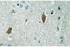Immunohistochemistry (IHC) analyzes of PAI-2 antibody in paraffin-embedded human brain tissue. (SERPINB2 anticorps)