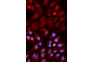 Immunofluorescence (IF) image for anti-Proteasome (Prosome, Macropain) Subunit, beta Type 2 (PSMB2) antibody (ABIN1876671)
