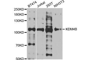 Western blot analysis of extracts of various cell lines, using KDM4B antibody (ABIN5973438) at 1/1000 dilution. (KDM4B anticorps)