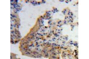 Used in DAB staining on fromalin fixed paraffin-embedded Lung tissue (IL-7 anticorps  (AA 26-154))