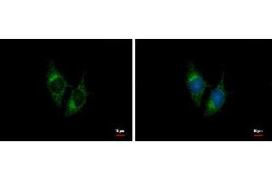ICC/IF Image BNP antibody [N1C3] detects BNP protein at cytoplasm by immunofluorescent analysis. (NPPB anticorps)