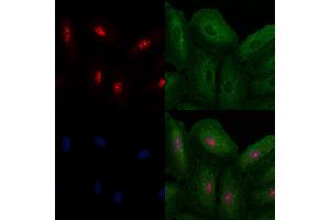 ABIN6260604 and ABIN6272502 staining  cells by IF/ICC. (CDK13 anticorps  (Internal Region))