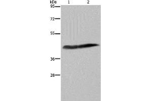 Western Blot analysis of Human placenta tissue and HepG2 cell using CD116 Polyclonal Antibody at dilution of 1:250 (CSF2RA anticorps)