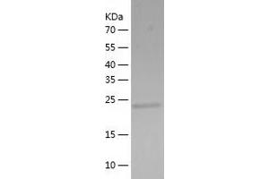 Western Blotting (WB) image for Suppressor of IKBKE 1 (SIKE1) (AA 1-207) protein (His-IF2DI Tag) (ABIN7125257)