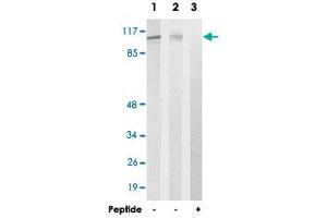 Western blot analysis of extracts from 293 cells (Lane 2) and HUVEC cells (Lane 1 and lane 3), using EFTUD2 polyclonal antibody . (EFTUD2 anticorps)