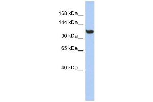 TMEM63C antibody used at 1 ug/ml to detect target protein. (TMEM63C anticorps  (Middle Region))